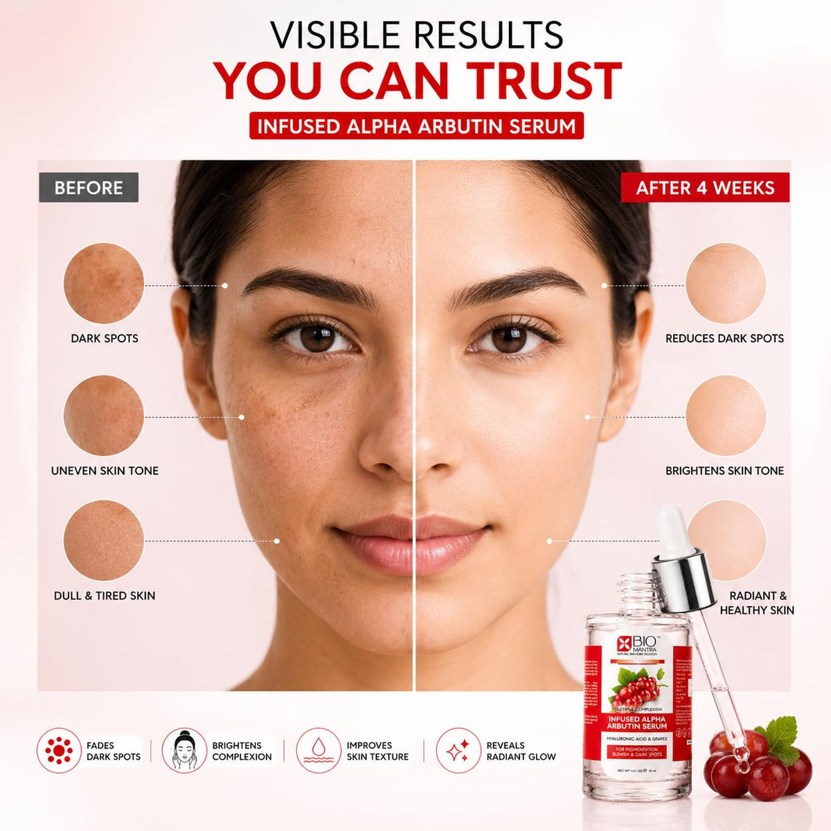 BIOMANTRA Alpha Arbutin Serum 30ml with Hyaluronic Acid & Aloe Vera | Skin Brightening Face Serum for Dark Spots, Pigmentation, Uneven Skin Tone & Hydration | Serum for Men & Women